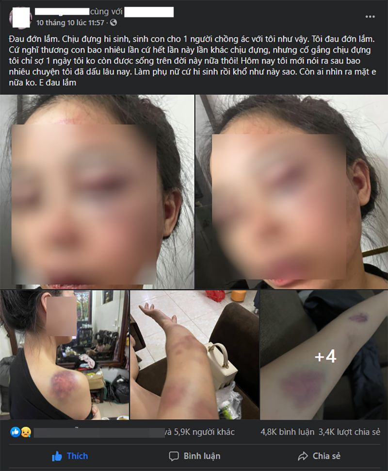 Nóng: Vợ 9X bị chồng bạo hành xuyên đêm, dùng cả gậy sắt đánh tới biến dạng khuôn mặt-1