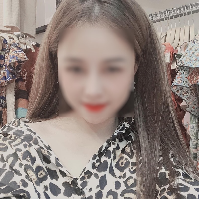 Nóng: Vợ 9X bị chồng bạo hành xuyên đêm, dùng cả gậy sắt đánh tới biến dạng khuôn mặt-11