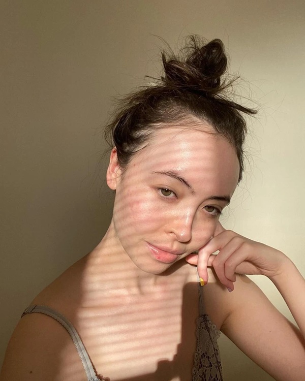 SỰ THẬT: Retinol có thể gây kích ứng gấp đôi vào mùa hanh khô?-4