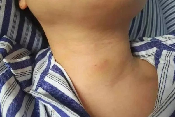 Bệnh tuyến giáp là tác nhân khiến phụ nữ khó đậu thai: Rất tiếc nhiều phụ nữ lại dễ nhầm với dấu hiệu ngày đèn đỏ-6