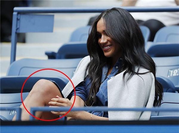 Người ta chê Meghan Markle kém duyên khi mặc váy, dáng đứng của cô phản hồi: Đúng rồi!-10