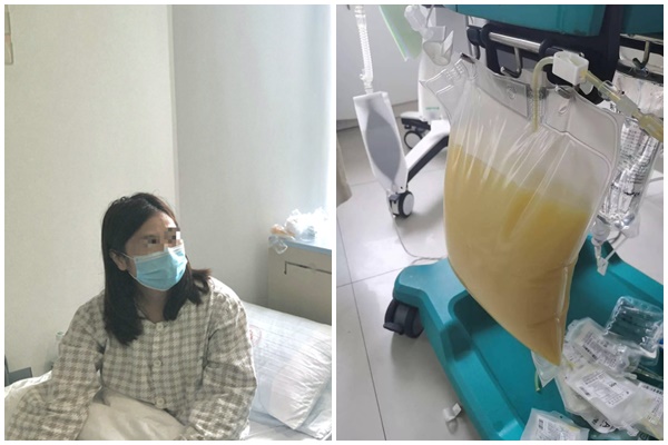 Con trai 2 tuổi ho khò khè mãi không hết, nửa năm sau bác sĩ lôi ra một thứ từ phế quản đứa trẻ mà gia đình sốc nặng-3