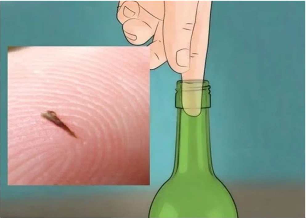 Dằm mắc vào tay khó chịu, áp dụng ngay 7 mẹo này giúp loại bỏ dễ dàng-1