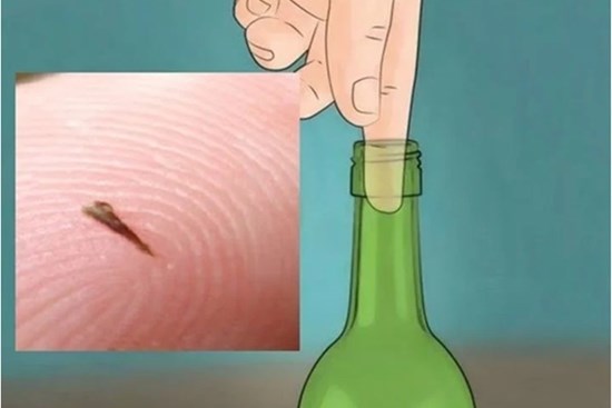 Dằm mắc vào tay khó chịu, áp dụng ngay 7 mẹo này giúp loại bỏ dễ dàng