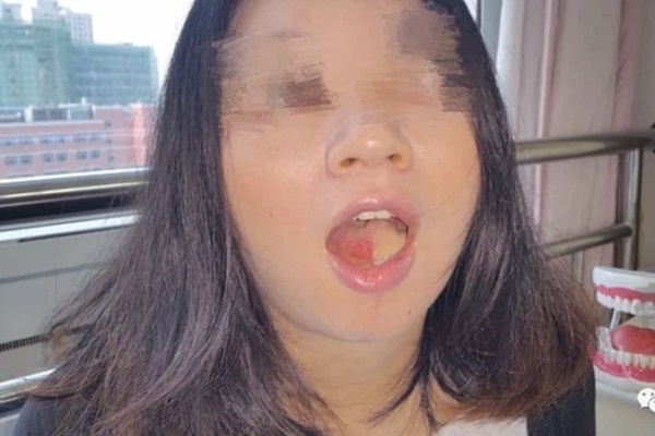 Mới 7 tuổi bé trai đã mắc ung thư, bố mẹ ân hận vì thường xuyên nấu thịt cho con ăn theo cách nguy hiểm này-6