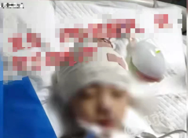 Con trai nói buồn ngủ sau khi ngã từ ghế sofa, tuyên bố của bác sĩ khiến mẹ ân hận vì sai lầm khiến con tàn tật suốt đời-4