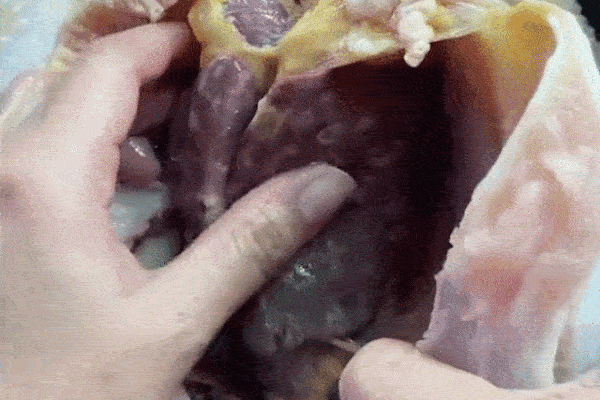 Cứ nhắm mắt ngủ lại thấy cơ thể xuất hiện 4 dấu hiệu kỳ lạ này, bạn cần phải đi khám ung thư khẩn cấp-5