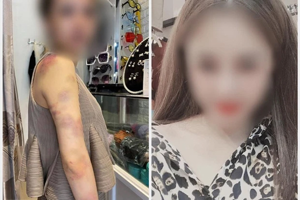 Clip: Bé gái gần 2 tuổi bị bạn học đánh, đạp dã man suốt 4 phút ngay trong lớp học của trường mầm non-2