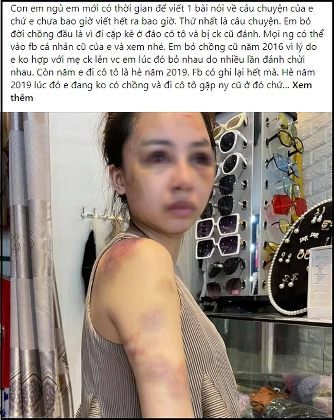 Cô vợ trong vụ bị chồng đánh đập dã man lên tiếng bài phốt của anh ta: Đêm kinh hoàng và pha tự cứu mình nghẹt thở-1