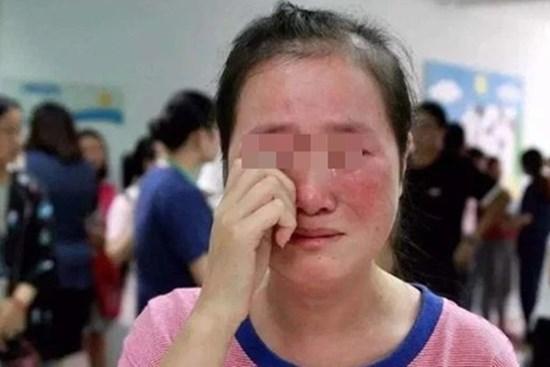 Người phụ nữ có 3 đời chồng đều chết vì ung thư gan, bác sĩ xem hình ảnh 1 món ăn của gia đình rồi tiết lộ lý do khiến ai cũng sốc