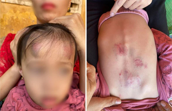 Xôn xao clip bé gái 2 tuổi bị bạn đánh bầm dập cả người, cô giáo không hề hay biết-1