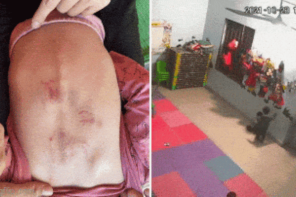 Tại sao trẻ mẫu giáo lại bạo lực đến vậy? Nguyên nhân do đâu?-2