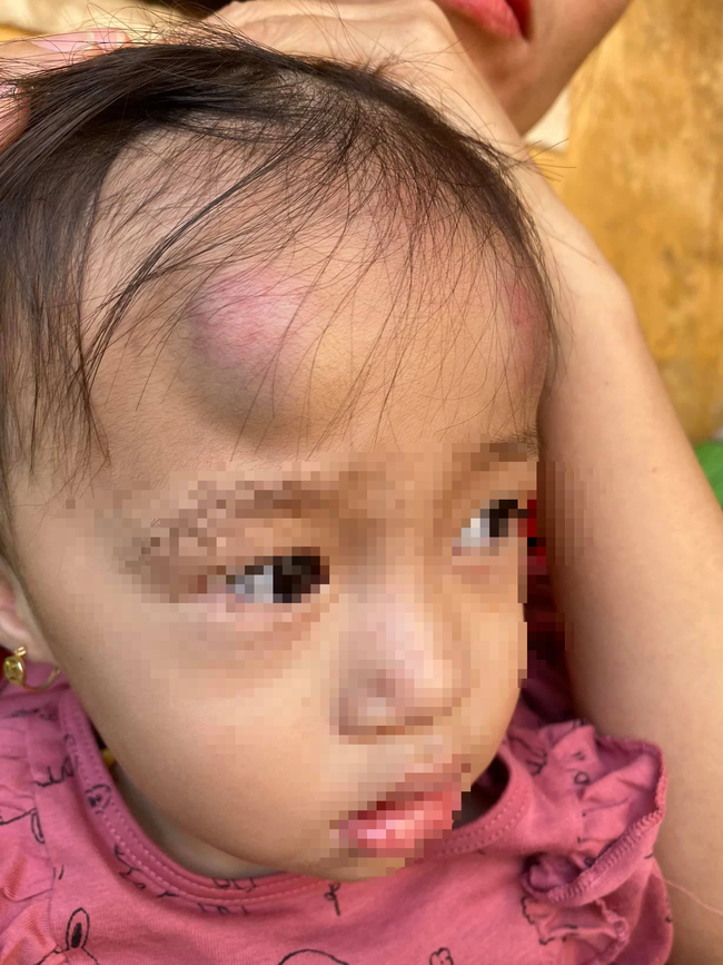 Từ vụ bé gái 2 tuổi bị bạn đánh dã man trong lớp, phụ huynh tranh cãi có nên cho con đi học sớm hay không?-3