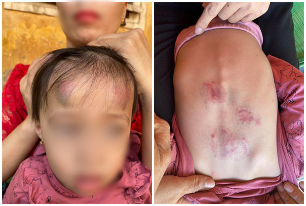 Vụ bé gái 2 tuổi bị bạn học đánh đạp dã man: Tạm đình chỉ hoạt động nhóm trẻ mầm non Vân Vũ cho trẻ 2,3,4 tuổi ở lẫn lộn-1