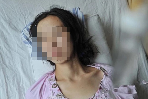 Người phụ nữ 30 tuổi phát hiện mắc ung thư trực tràng giai đoạn cuối vì thường xuyên ăn loại thịt nhiều người vô cùng yêu thích-1