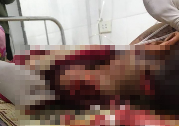 Vụ bé trai 8 tuổi bị chém nhiều nhát tử vong khi ở nhà một mình: Thời điểm xảy ra vụ việc không ai nghe thấy tiếng kêu cứu hay la hét nào-1