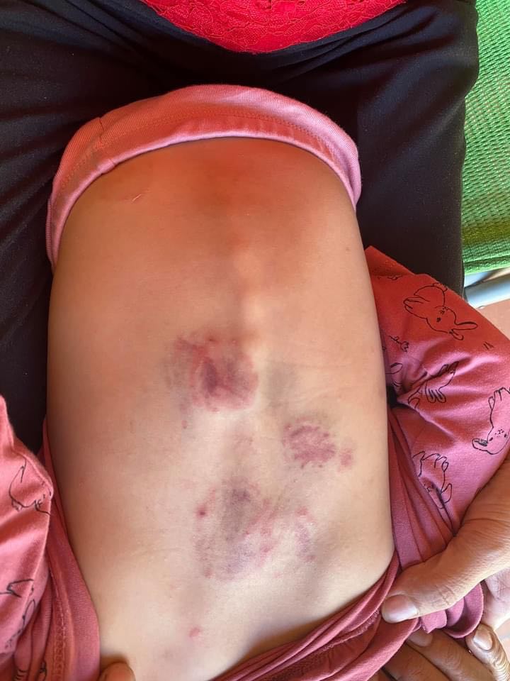 Từ vụ bé gái 2 tuổi bị đánh dã man ở trường mầm non: Bố mẹ cần làm gì khi con có khuynh hướng bạo lực?-2