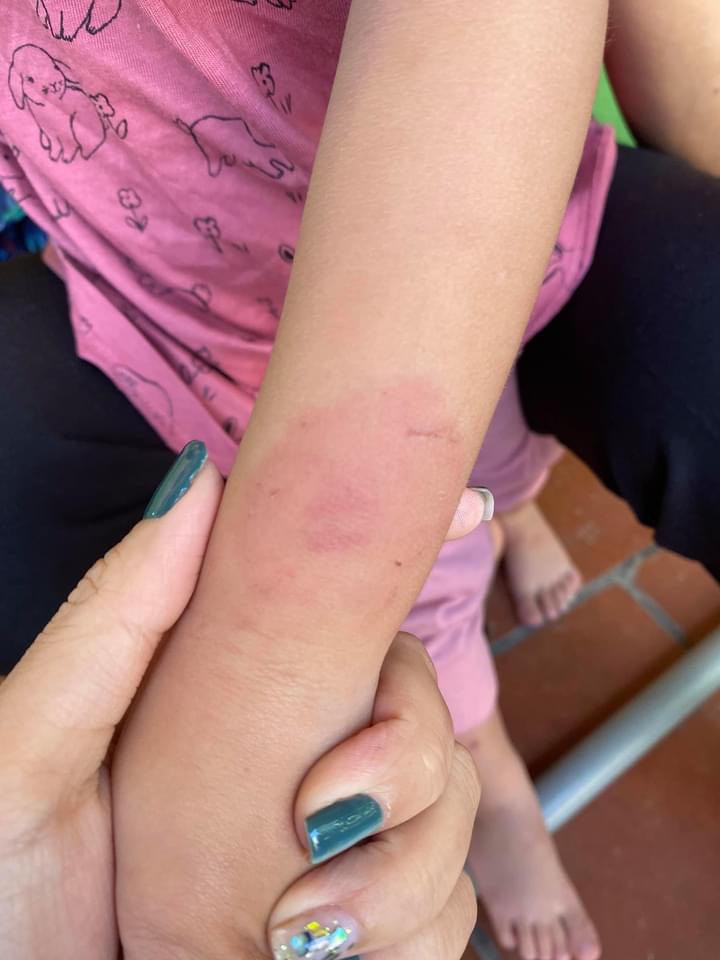 Từ vụ bé gái 2 tuổi bị đánh dã man ở trường mầm non: Bố mẹ cần làm gì khi con có khuynh hướng bạo lực?-3