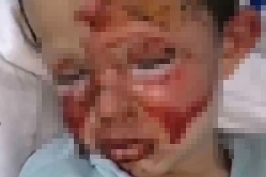 Cay cú trong cuộc chiến ly hôn với vợ, gã đàn ông ác quỷ trút giận lên đứa con trai 4 tuổi để lại cảnh tượng đau thắt ruột gan