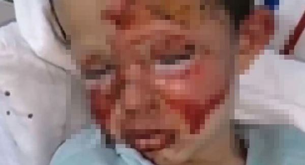 Cay cú trong cuộc chiến ly hôn với vợ, gã đàn ông ác quỷ trút giận lên đứa con trai 4 tuổi để lại cảnh tượng đau thắt ruột gan-2