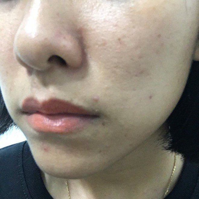 Tẩy trang theo cách này thì đừng hỏi tại sao da lên mụn, chảy xệ và lão hoá-3