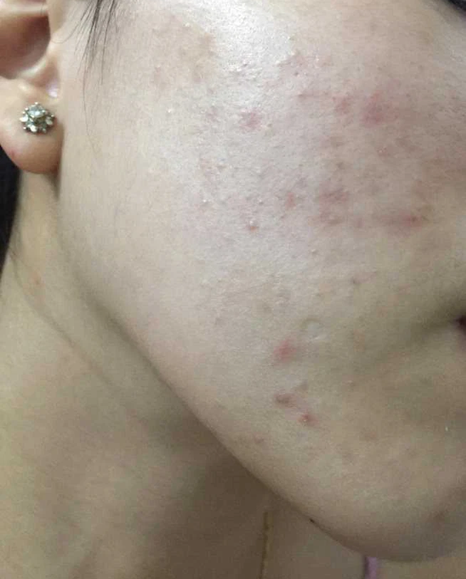 Tẩy trang theo cách này thì đừng hỏi tại sao da lên mụn, chảy xệ và lão hoá-5