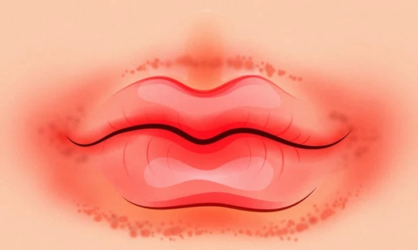 5 bất thường ở môi cảnh báo nhiều loại bệnh tật nguy hiểm nhưng ít người biết-1
