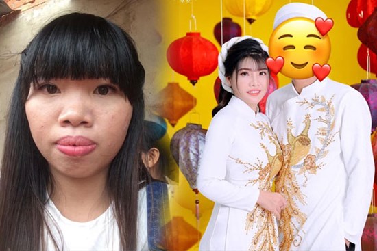 Cuộc sống hiện tại của Phượng “Thị Nở”: Chồng mới yêu chiều nhưng phải giấu mặt vì 1 lý do