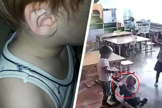 Mẹ đón con từ trường về với vết thâm tím trên cổ, bủn rủn tay chân khi xem lại camera nhưng giận run người với câu trả lời của giáo viên