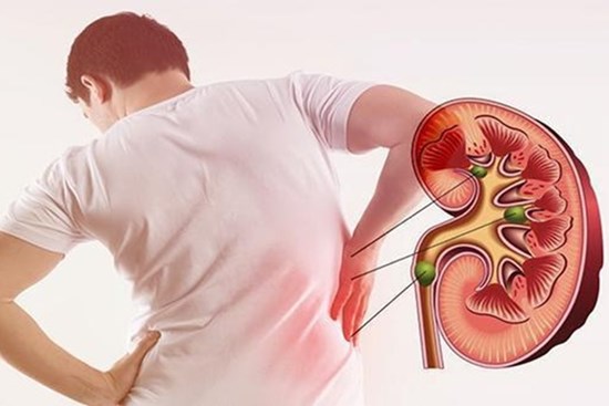 Thói quen tưởng vô hại nhưng lại là nguyên nhân khiến thận chứa cả