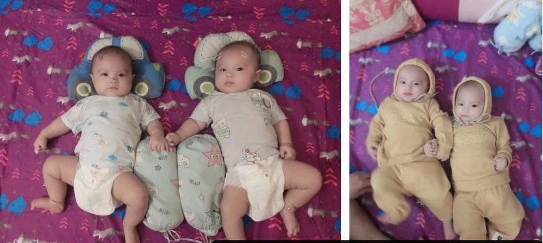 Mẹ bỉm sợ hãi, tự ti vì bụng vừa đen vừa xổ, rạn ngứa gây đau đớn sau sinh đôi 2 con trai-3