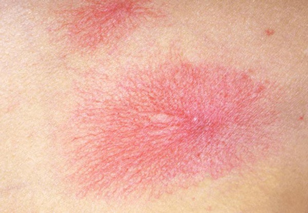 Người phụ nữ 31 tuổi qua đời vì ung thư gan, nguyên nhân xuất phát từ 1 loại cốc mà nhiều gia đình vẫn sử dụng hàng ngày-5