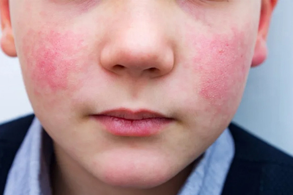 4 bữa sáng khoái khẩu của nhiều người nhưng lại là sát thủ gây thối gan, cần từ bỏ ngay trước khi ung thư ập đến-4