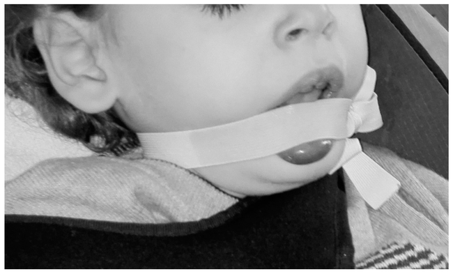 Bí ẩn căn bệnh tự ăn thịt chính mình gây kinh hãi đến ngày nay, đáng sợ nhất là đối tượng mắc bệnh chỉ toàn trẻ nhỏ-2