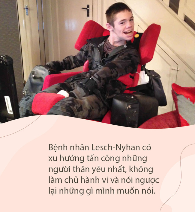 Bí ẩn căn bệnh tự ăn thịt chính mình gây kinh hãi đến ngày nay, đáng sợ nhất là đối tượng mắc bệnh chỉ toàn trẻ nhỏ-5