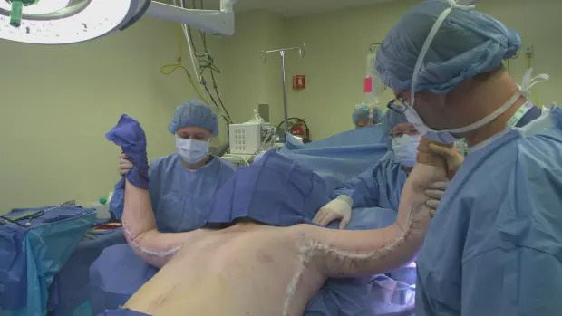 Người béo nhất thế giới nặng gần nửa tấn: Rùng mình lớp mỡ thừa cắt ra, kế hoạch hoả táng ở lò mổ gia súc và hình ảnh sau 10 năm như ác mộng-4