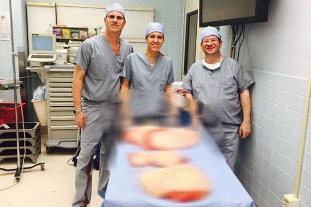 Người béo nhất thế giới nặng gần nửa tấn: Rùng mình lớp mỡ thừa cắt ra, kế hoạch hoả táng ở lò mổ gia súc và hình ảnh sau 10 năm như ác mộng-5