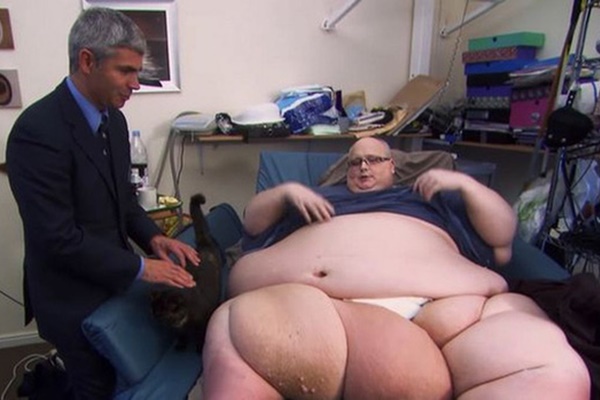 Thiếu niên béo nhất thế giới nặng 610kg, di chuyển phải dùng cần cẩu gây sốc khi trưởng thành, nhìn vào không ai dám tin là một người-7