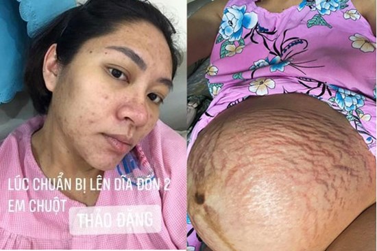 Sao Việt xấu xí vì bầu bí: Người được nuông chiều, kẻ bị phụ bạc