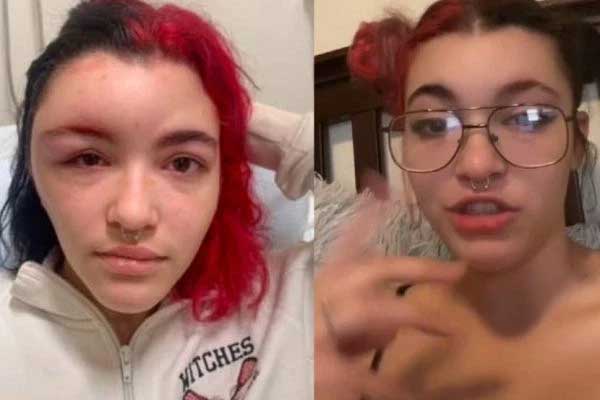 Mua thuốc tự nhuộm tóc tại gia, cô gái nhận kết cục bẽ bàng mái đầu xiêu vẹo đến mức người thân không nhận ra-1