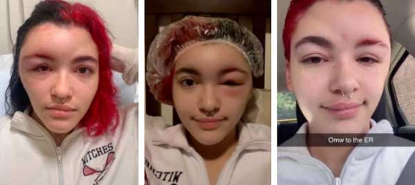 Mua thuốc tự nhuộm tóc tại gia, cô gái nhận kết cục bẽ bàng mái đầu xiêu vẹo đến mức người thân không nhận ra-2