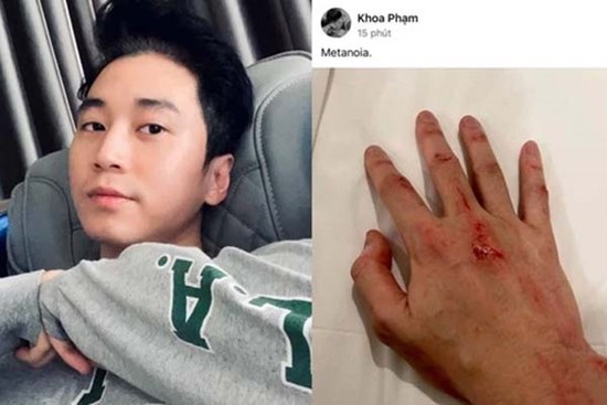 Karik gây lo lắng với bức ảnh bàn tay trầy xước dính máu, chuyện gì đây?