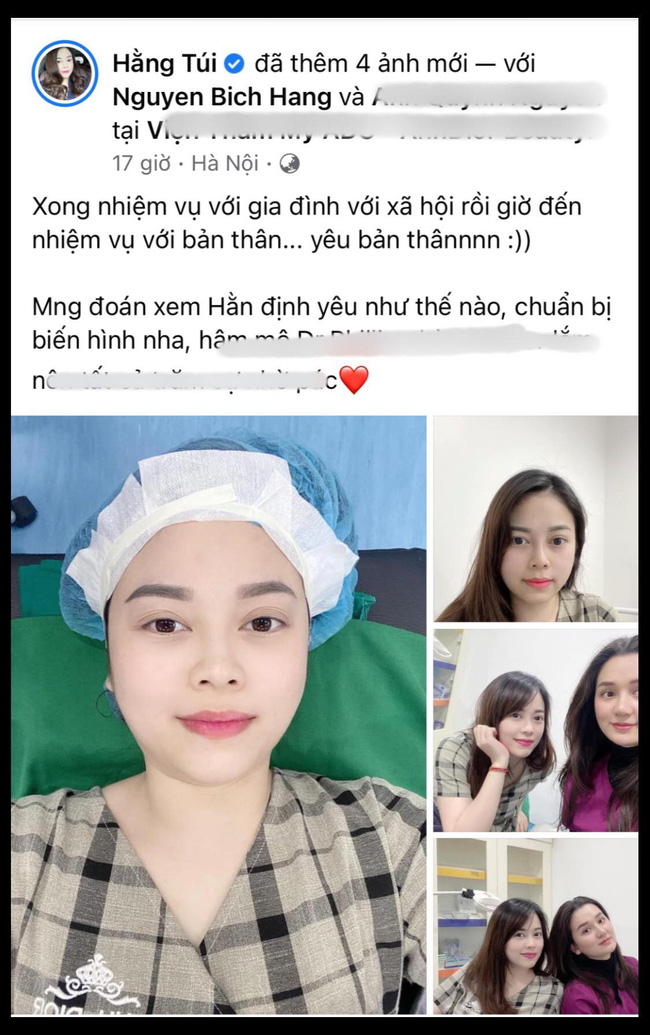 Hằng Túi quyết định làm một việc để tuốt lại nhan sắc sau 5 lần chửa đẻ-1