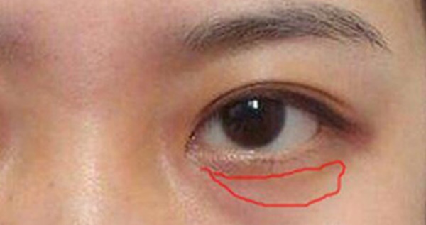 4 biểu hiện trên khuôn mặt cho thấy nữ giới đang mắc bệnh phụ khoa, chỉ cần phát hiện ra 1 cái cũng cần đi khám ngay-1