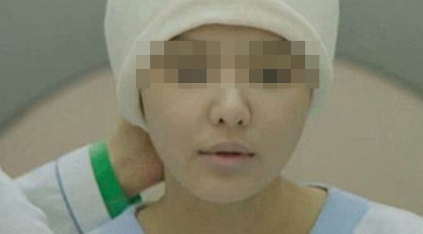 4 biểu hiện trên khuôn mặt cho thấy nữ giới đang mắc bệnh phụ khoa, chỉ cần phát hiện ra 1 cái cũng cần đi khám ngay-4