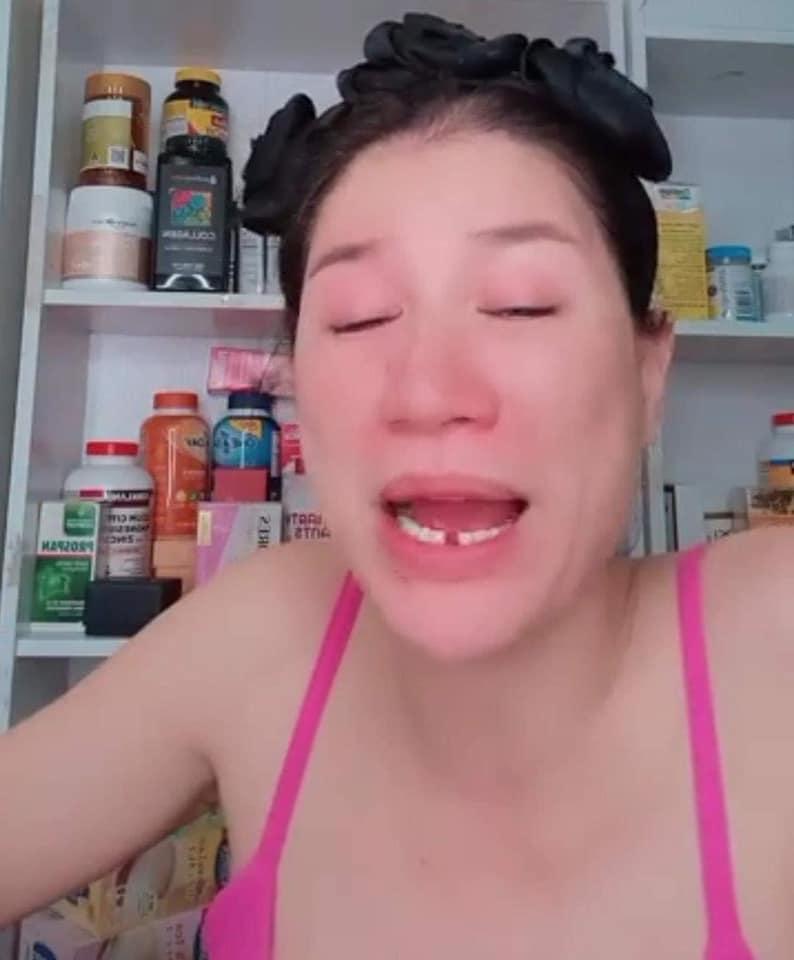 Ngã vật ra với lý do khiến Trang Trần gãy răng cửa-1