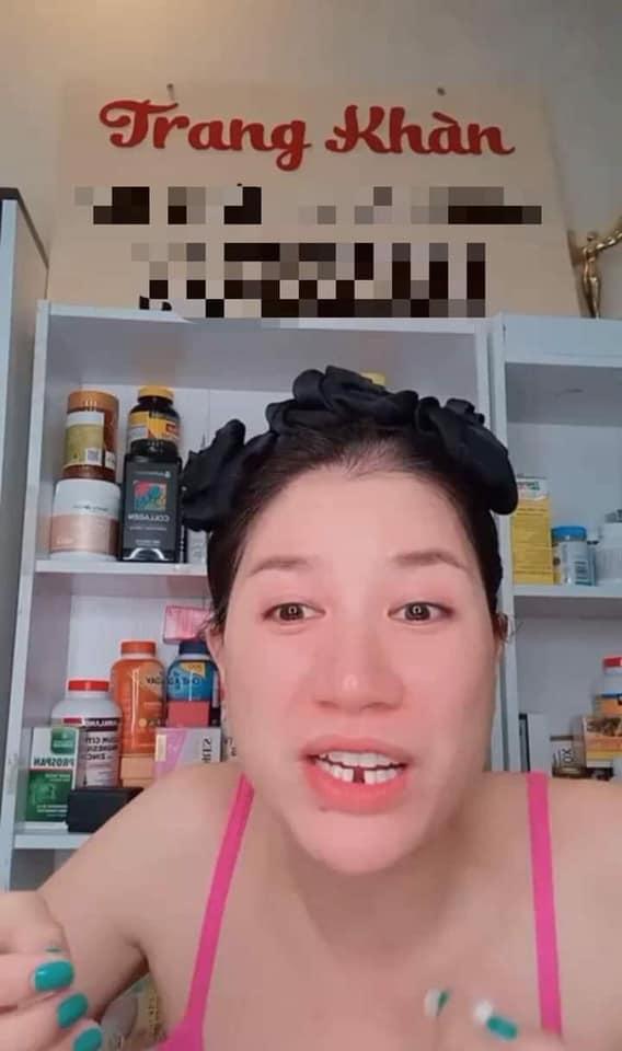Ngã vật ra với lý do khiến Trang Trần gãy răng cửa-2