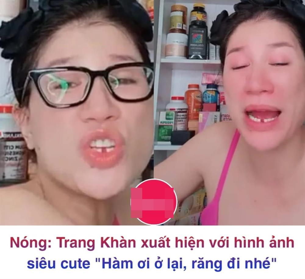 Ngã vật ra với lý do khiến Trang Trần gãy răng cửa-3