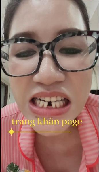 Ngã vật ra với lý do khiến Trang Trần gãy răng cửa-6