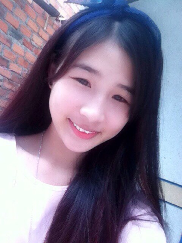 Cô gái bị méo miệng, liệt nửa mặt vì một thói quen ăn uống hàng triệu người trẻ đang có, ngoại hình sau khi can thiệp thẩm mỹ thực sự đáng kinh ngạc-1